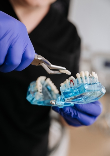 girl showcasing an extraction