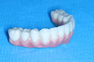Implant
