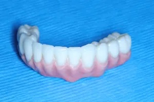 Bottom Implant